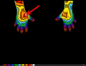Dorsal Hands Color