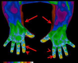 Dorsal Hands and Forearm Color