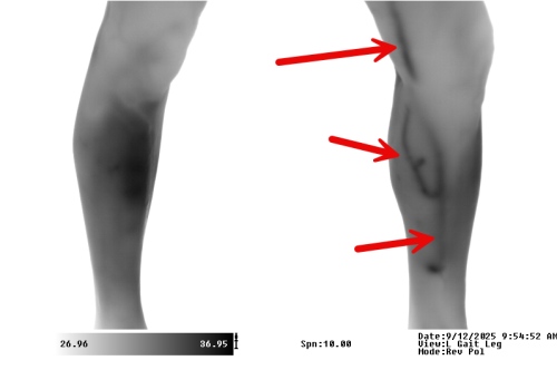 Anterior Legs Grayscale