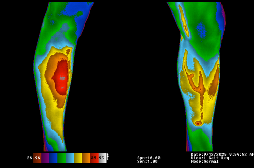 Anterior Legs Color